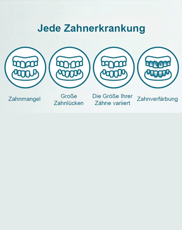 【 Essen + Trinken wie mit echten Zähnen】 Realistische & Anpassbare Zahnblende (Set für Oben + Unten) | Zahnarzt-Empfehlung | 3-Minuten Selbstanpassung | MedizinischerKunststoff 🦷✨