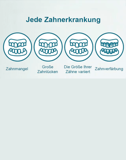 【 Essen + Trinken wie mit echten Zähnen】 Realistische & Anpassbare Zahnblende (Set für Oben + Unten) | Zahnarzt-Empfehlung | 3-Minuten Selbstanpassung | MedizinischerKunststoff 🦷✨