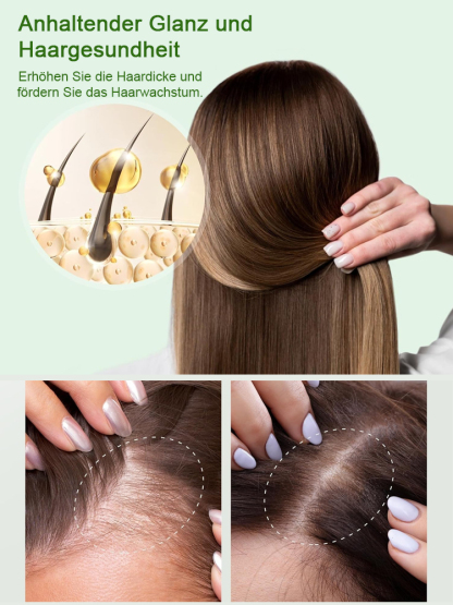 Hoegoa Rosmarin Keratin Shampoo | Empfohlen von Dermatologen | 10x Haarwuchs-Konzentrat | Stoppt Haarausfall & schafft Volumen | Ohne Silikone | Vegan 🌿💆