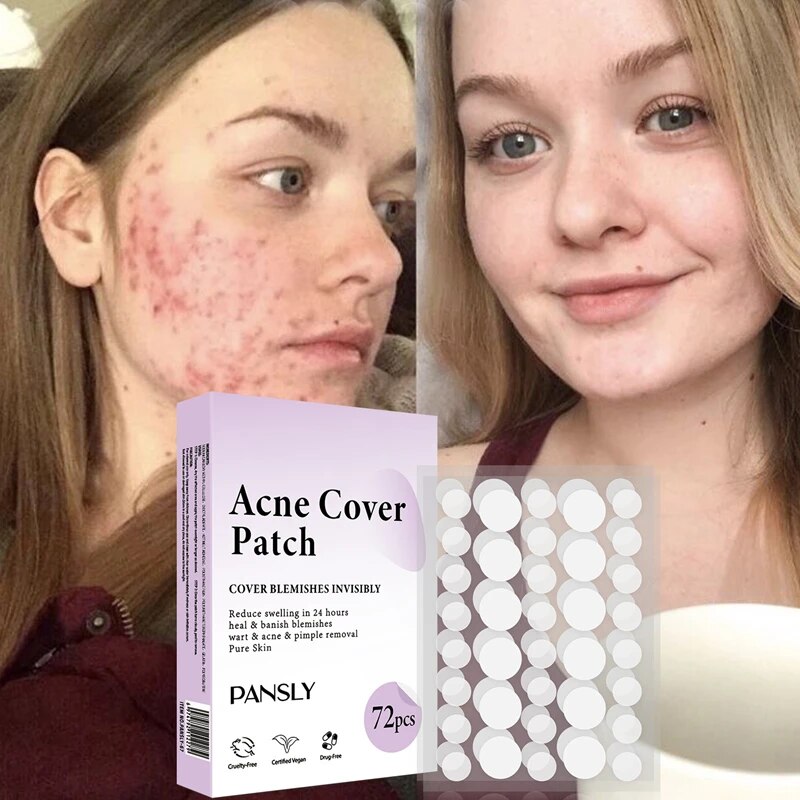 72 Pcs Invisible Healing  Face Acne Cover Patches-GLUTIONE