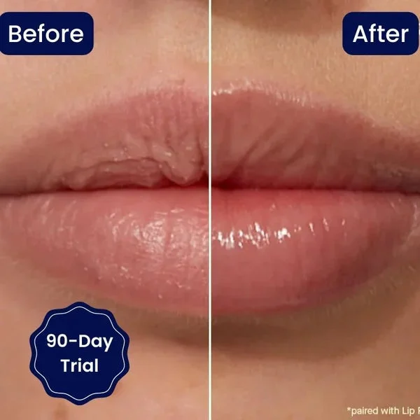 😍BIG SALE 🔥Vitamin E Lip Serum