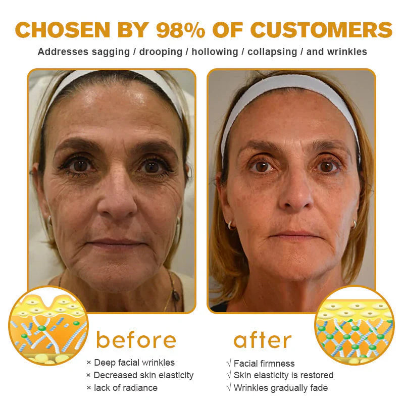 👨‍⚕️ Made and Shipped from US✅  Botox Bee Venom Wrinkle Removal Cream- LAST DAY 80% OFF