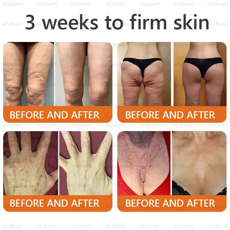 Zeinara Skin Firming & Tightening Cream with ShapePerfection™