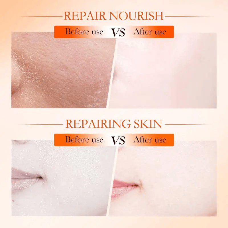 🔥Last 4 hours 49% OFF🔥 - SADOER Korean Toner