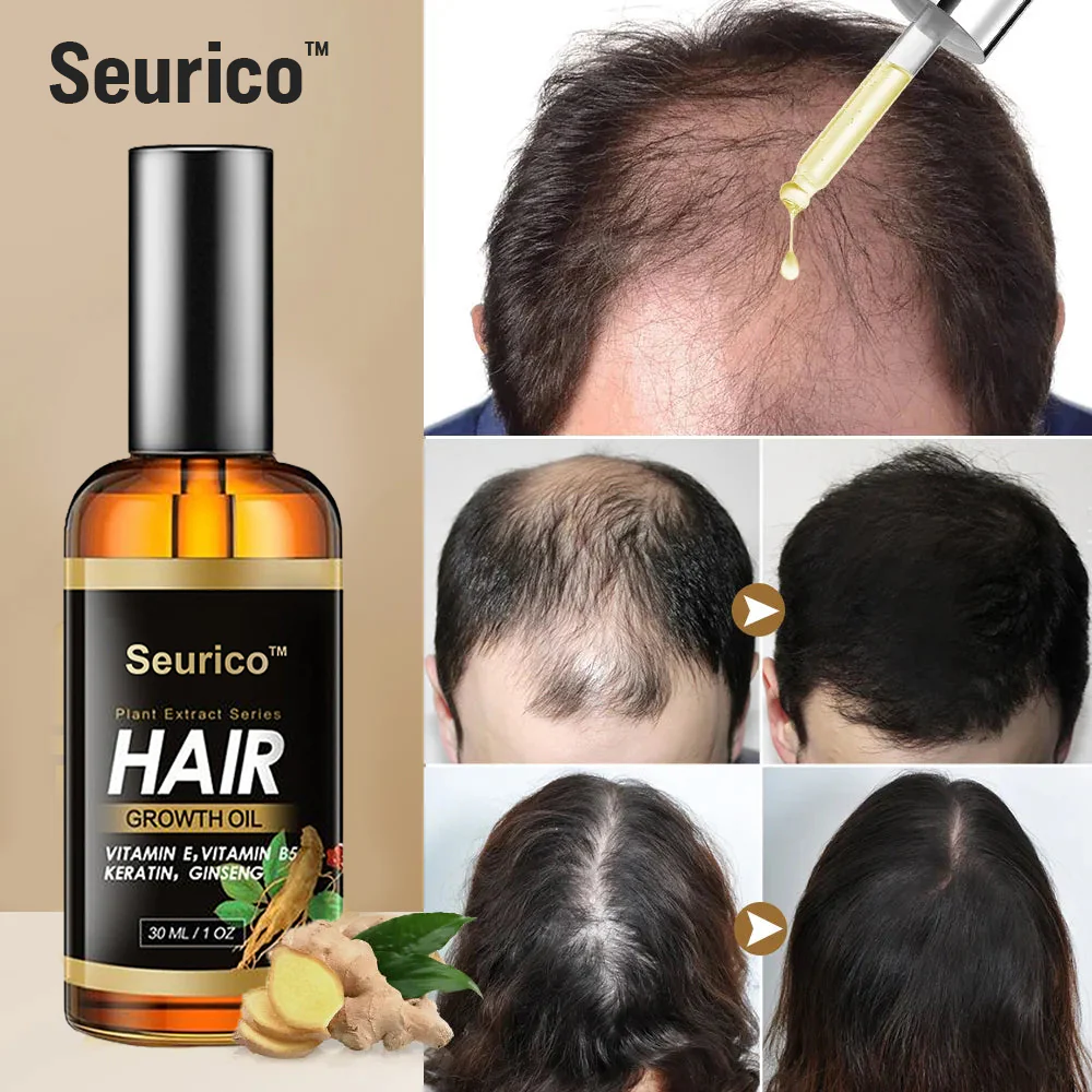 Seurico™ Rapid Hair Growth Serum - Rejuvenate your hair with our proven product!  (28478 Reviews)