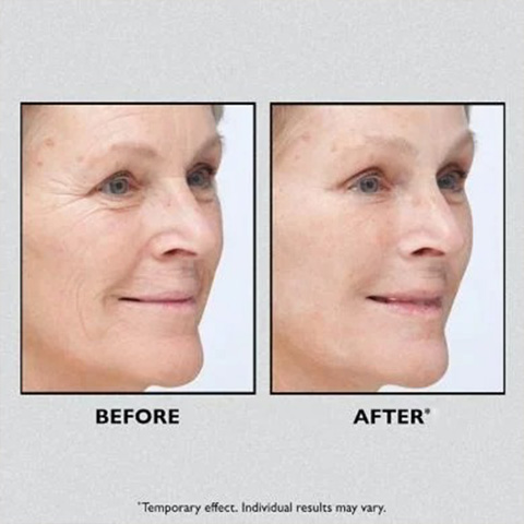  🎁Today 49% OFF🎁Temporary Face Tightener