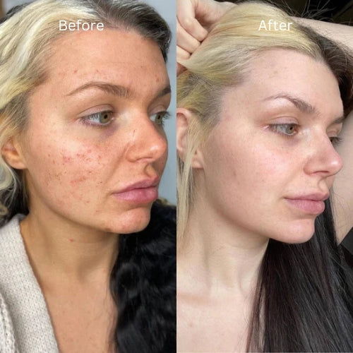 A313 Vitamin A Retinol Cream