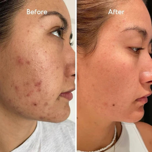 A313 Vitamin A Retinol Cream