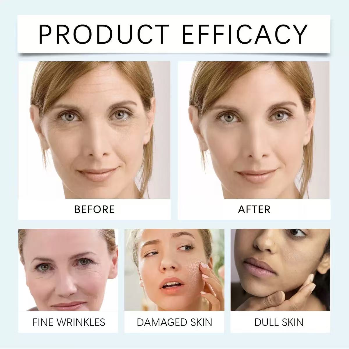 BOTOX STOCK SOLUTION ANTI-AGING SERUM