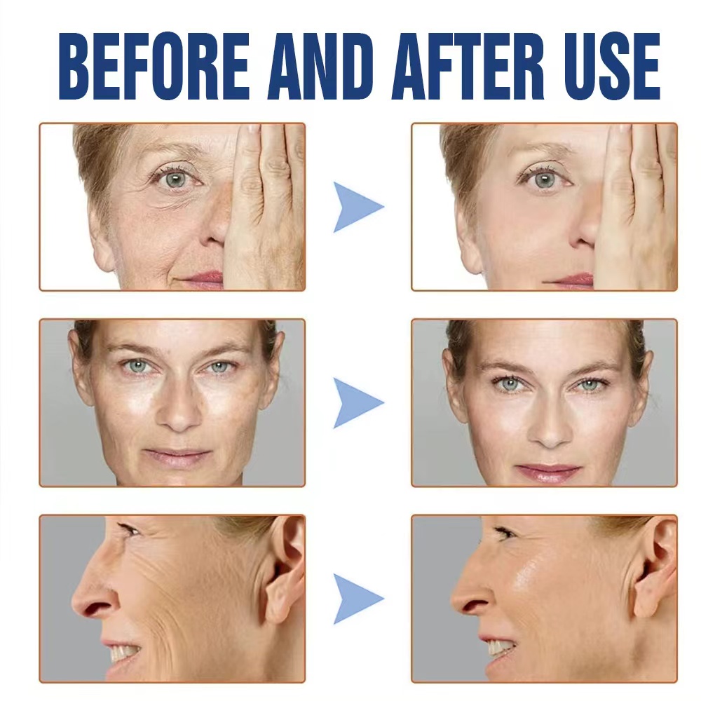Botox Liquid Solution Anti-Wrinkle Rejuvenating Serum