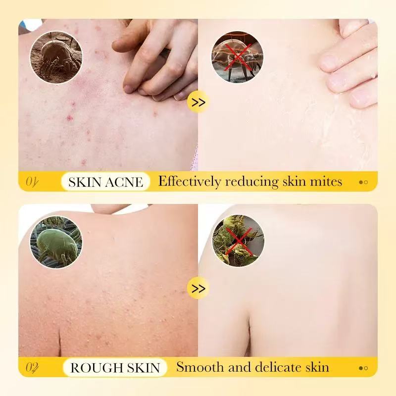 SADOER Anti-Acne Sulfur Mite Removal Liquid Soap （500ml)