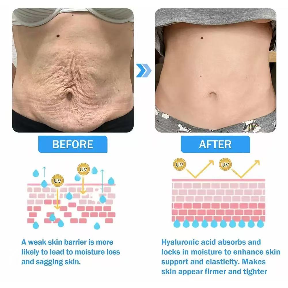 Skin Firm & Tighten Cream