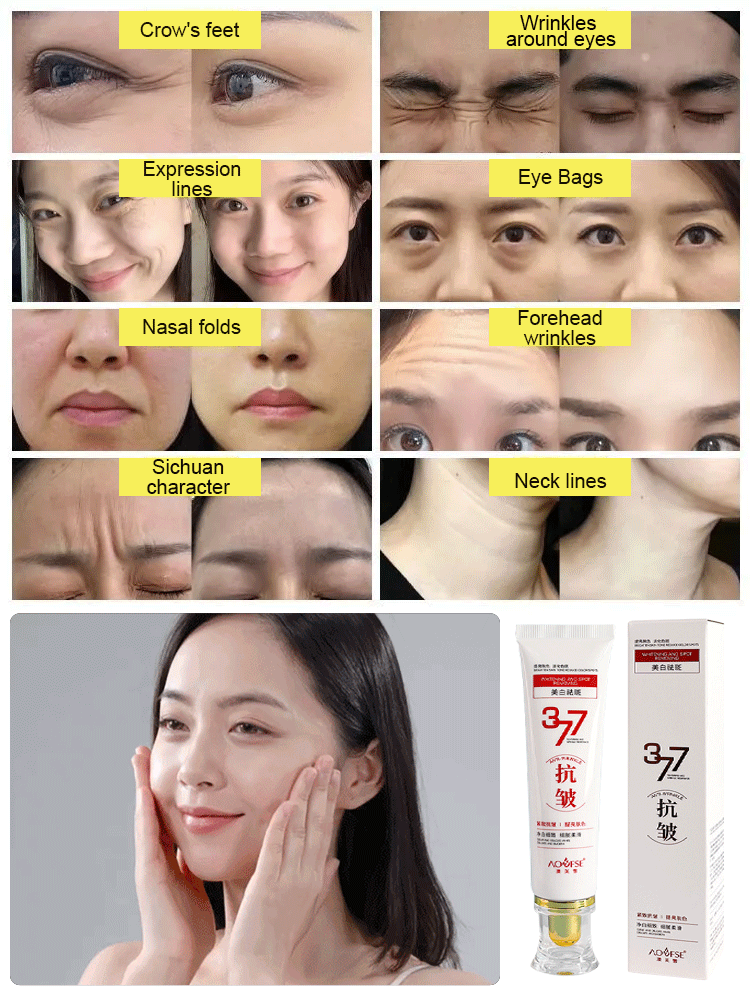 🔥LAST DAY SALE 70% OFF--377 Whitening Anti-wrinkle Cream
