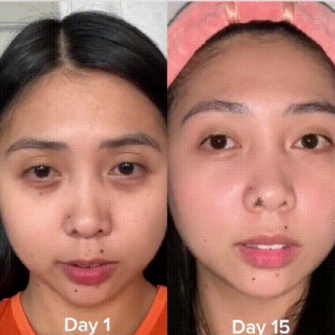 5D Peptide Anti-Wrinkle Eye Repair Cream