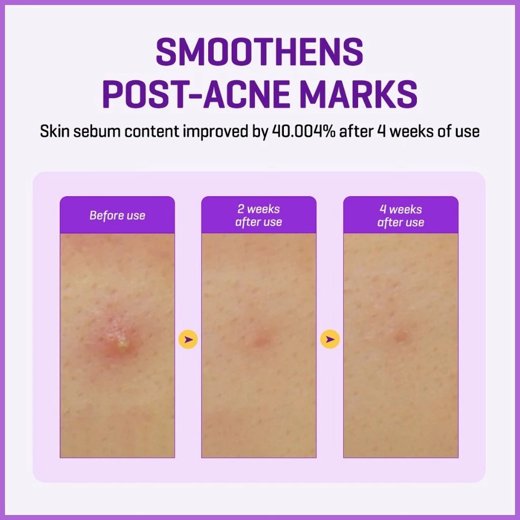 Retinol Intense Reactivating Serum