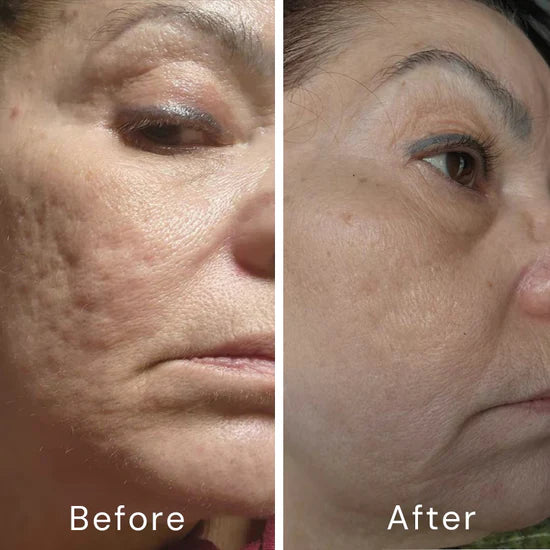 A313 Vitamin A Retinol Cream