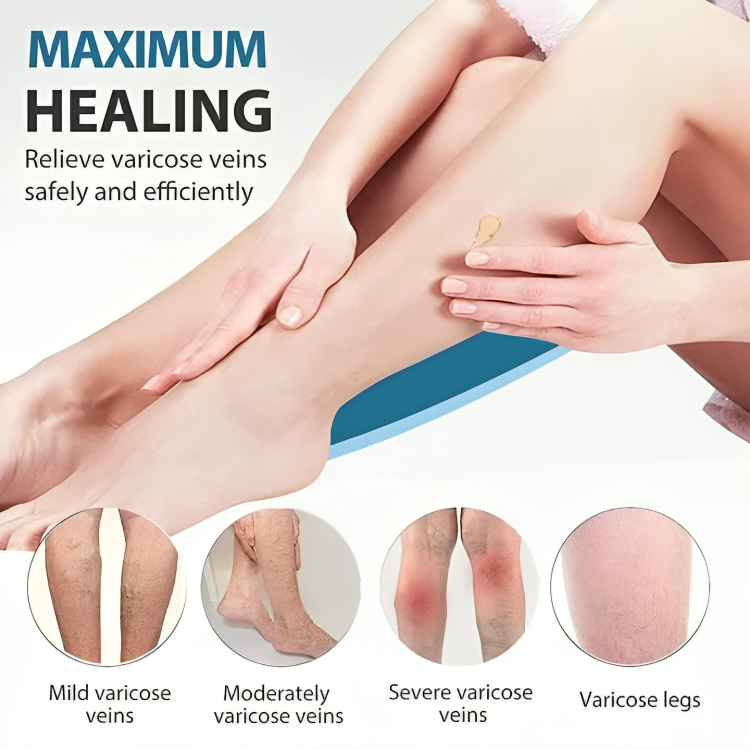 SUMIFUN VARICOSE VEINS CREAM