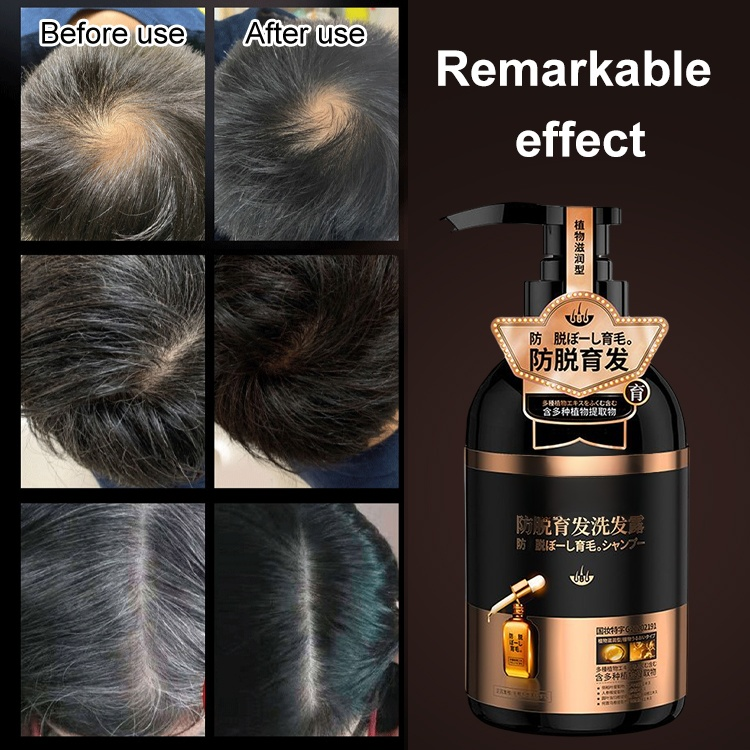 Thicker and natural-Anti-hair loss shampoo