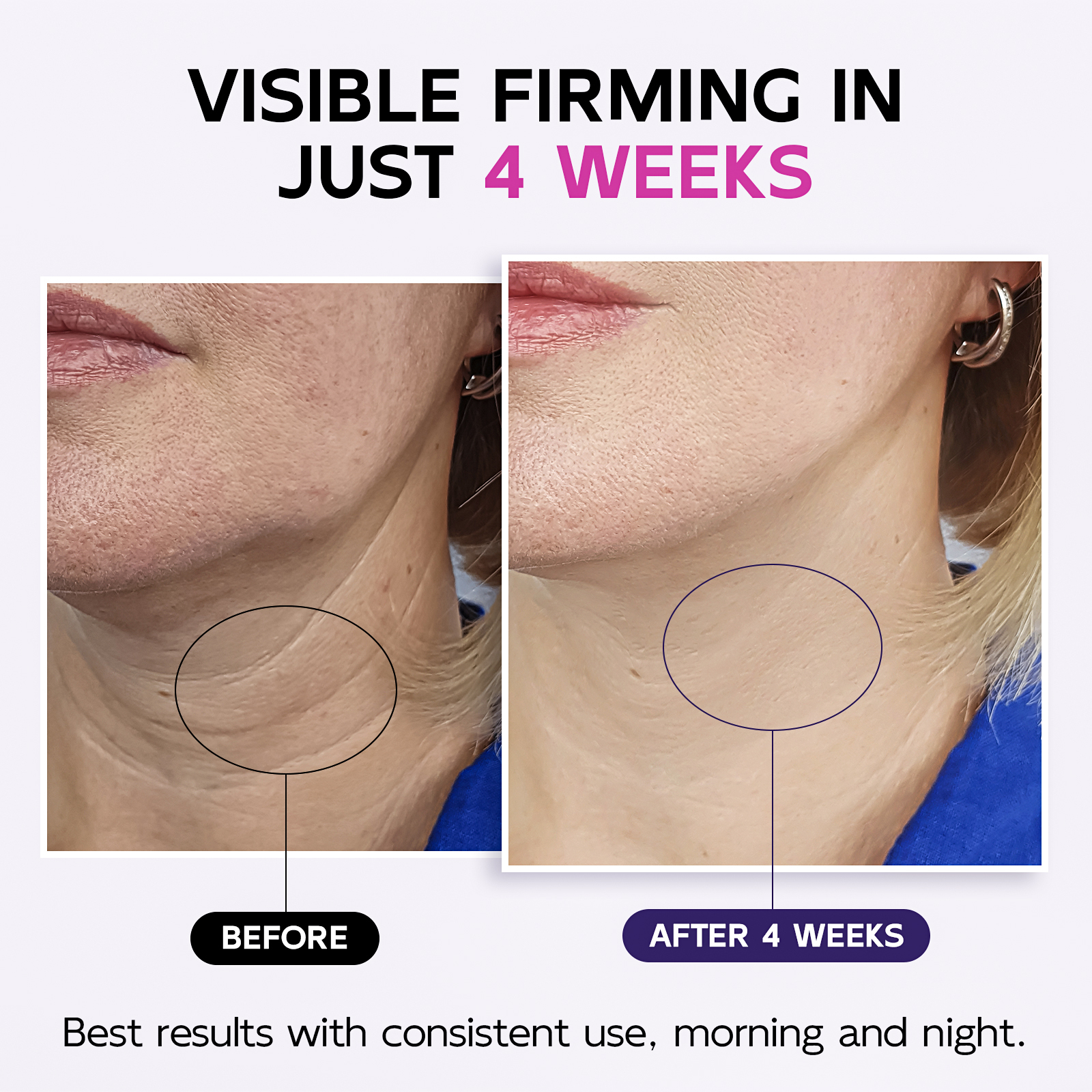 Firming Neck & Décolleté Cream