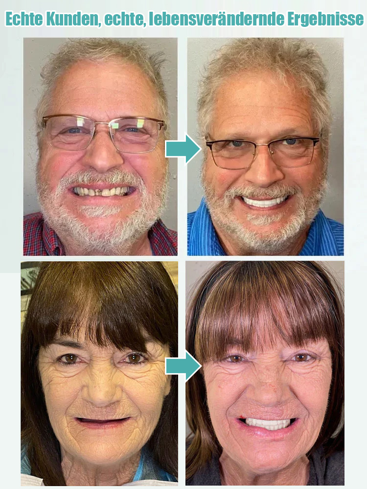 🔥👍Vollständige, verstellbare Zahnprothese für ein selbstsicheres Lächeln