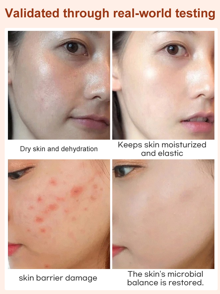 【Heart-Healthy Treat】🍃SesameFig™ - Calcium-Rich Snack for Cardiovascular Health！✅5x the Fiber of Regular Vegetables！