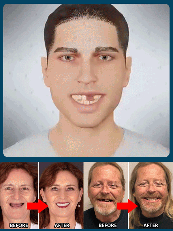 American Dental Association Recommended: Invisible Whitening Braces