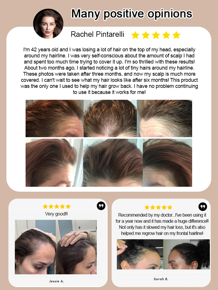 Ginger Herbal Anti-Hair Loss Hair Growth Shampoo Bar