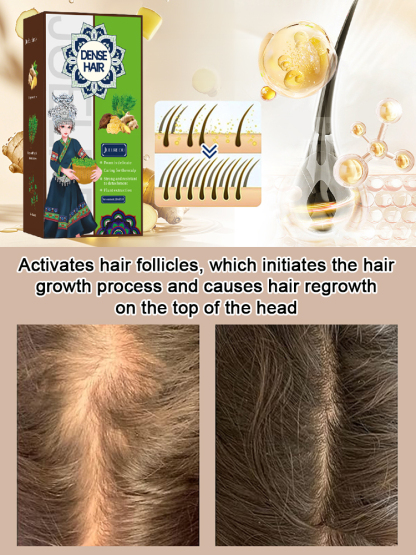 Ginger Herbal Anti-Hair Loss Hair Growth Shampoo Bar