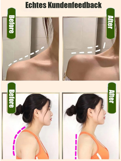  【TÜV Zertifiziert 】 TUM Technologie Nackenmassagegerät 4D |Bionic Griffe mit 45°C Wärme 💆