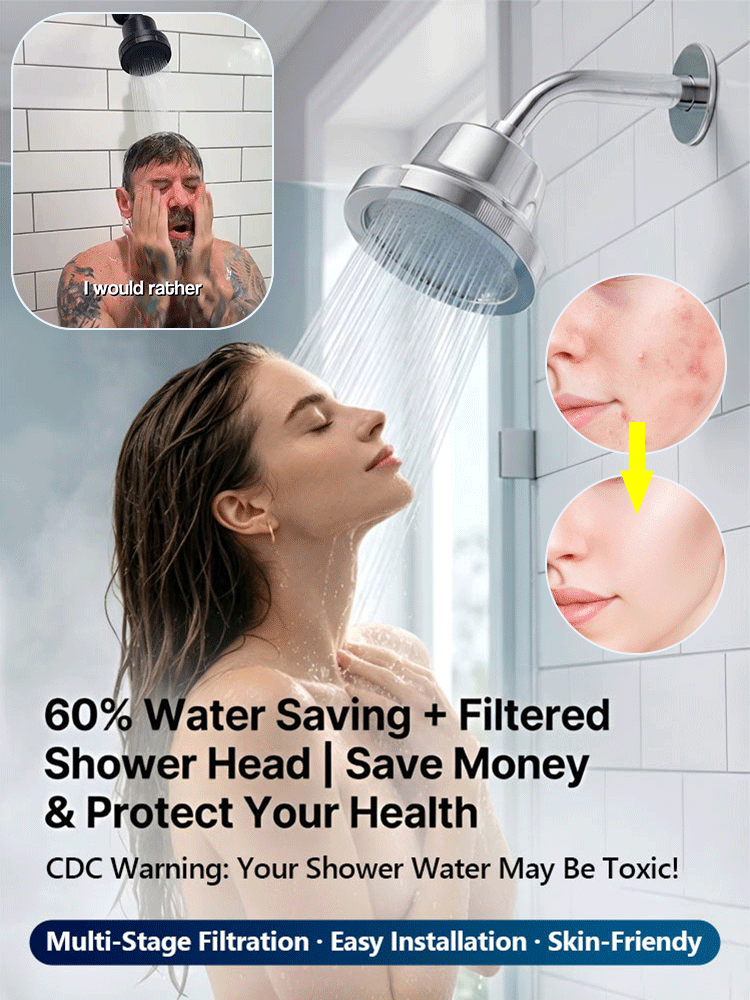 High-end German-made pressure-boosting shower head! Skin-care, pressure boosting, and water purification! Saves 60% on water bills compared to ordinary shower heads!