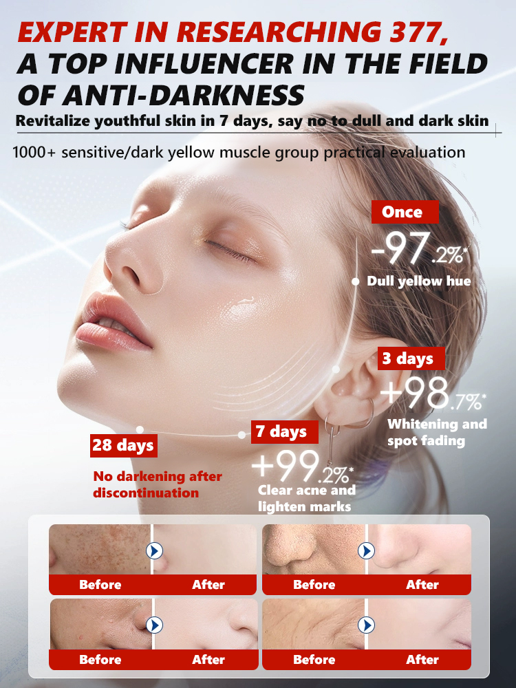 【3 in 1】Whitening, Anti-Blemish and Anti-Wrinkle Essence【See visible results in just 5 days!】