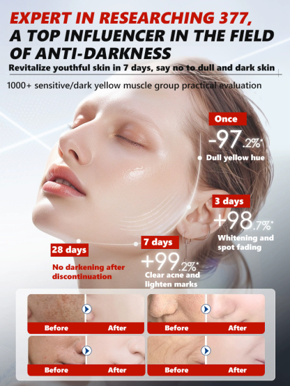 【3 in 1】Whitening, Anti-Blemish and Anti-Wrinkle Essence【See visible results in just 5 days!】