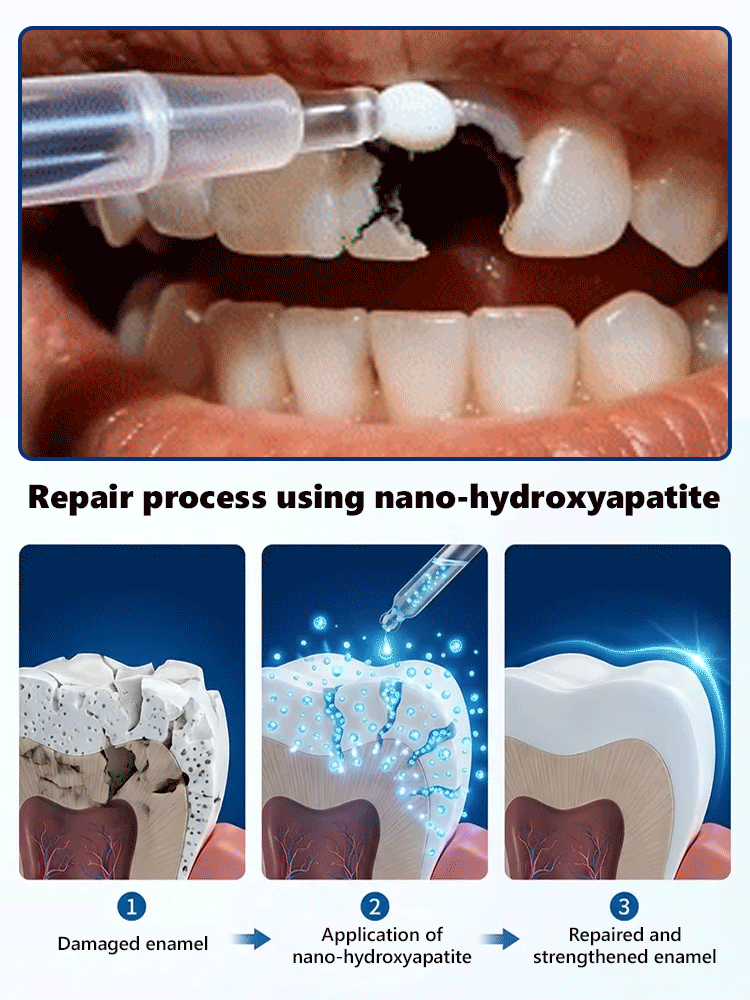 【Say Goodbye to Fake Braces & Grow New Teeth】Natural Tooth Growth Care Solution【Buy one, get one free!】