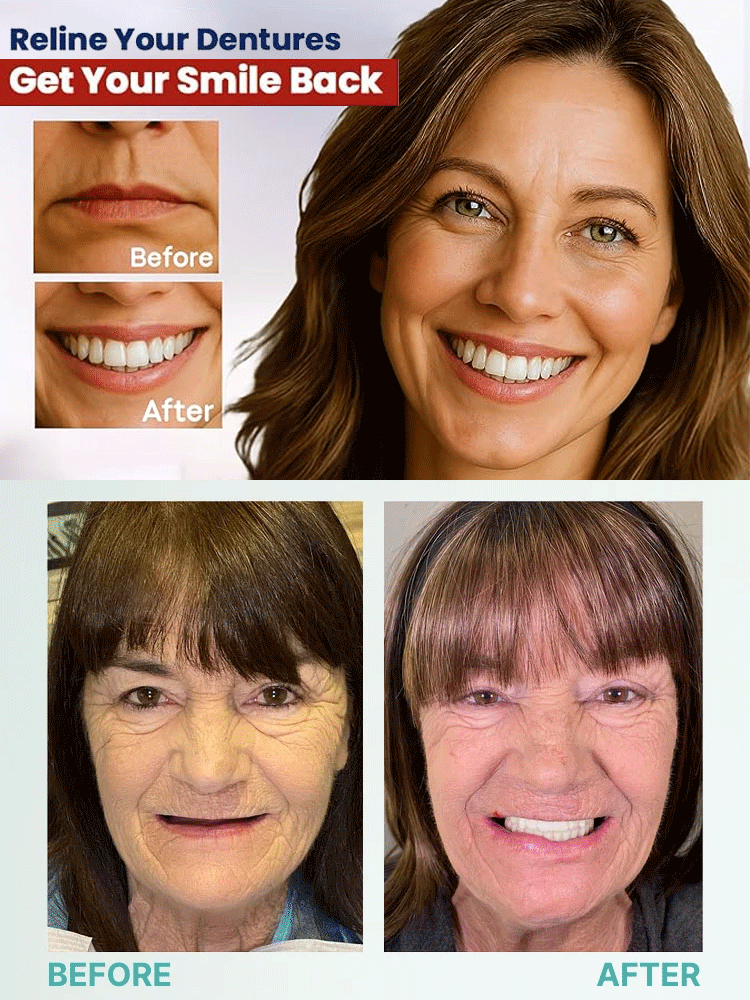 High-end custom-made full dentures【🔥Buy 1 Get 1 Free for a Limited Time!🔥】