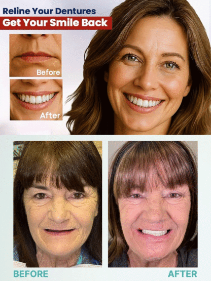 High-end custom-made full dentures【🔥Buy 1 Get 1 Free for a Limited Time!🔥】