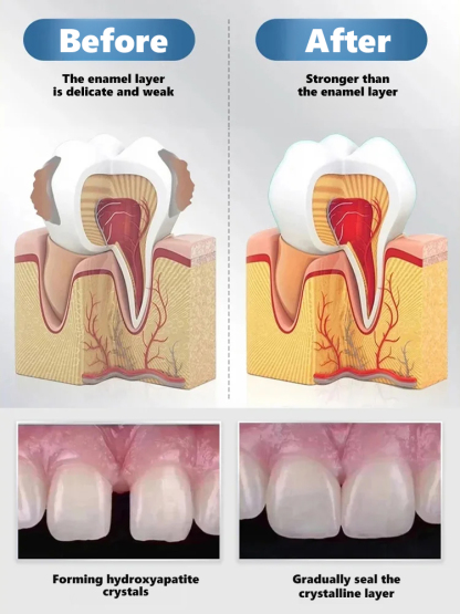 【Say Goodbye to Fake Braces & Grow New Teeth】Natural Tooth Growth Care Solution【Buy one, get one free!】