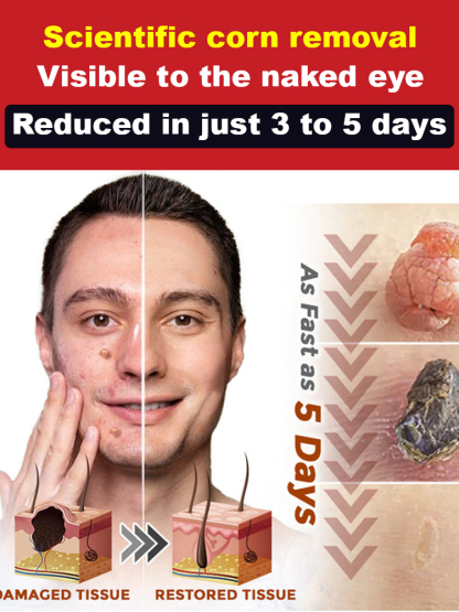 [Scar-Free] Painless Acne Patches【Buy 1 free 1】