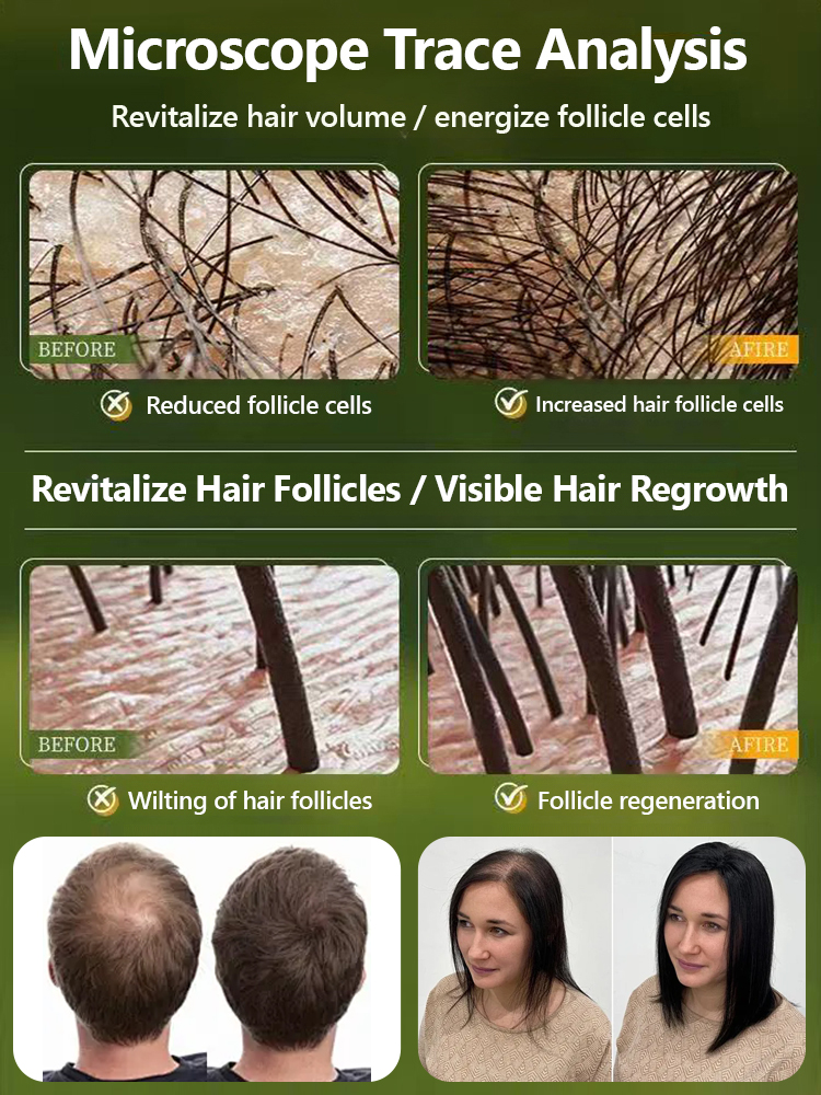 Palm Fruit Hair Growth Shampoo【Integrates hair growth, nourishment, and care, see noticeable changes in 7 days!】