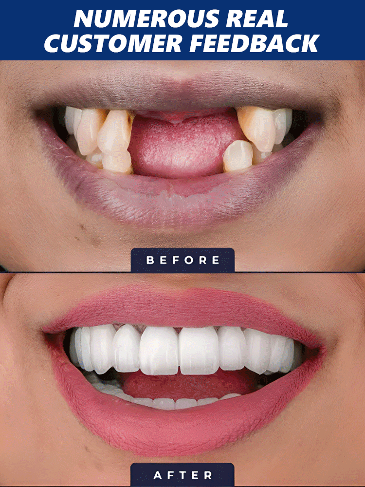 【Say Goodbye to Fake Braces & Grow New Teeth】Natural Tooth Growth Care Solution【Buy one, get one free!】