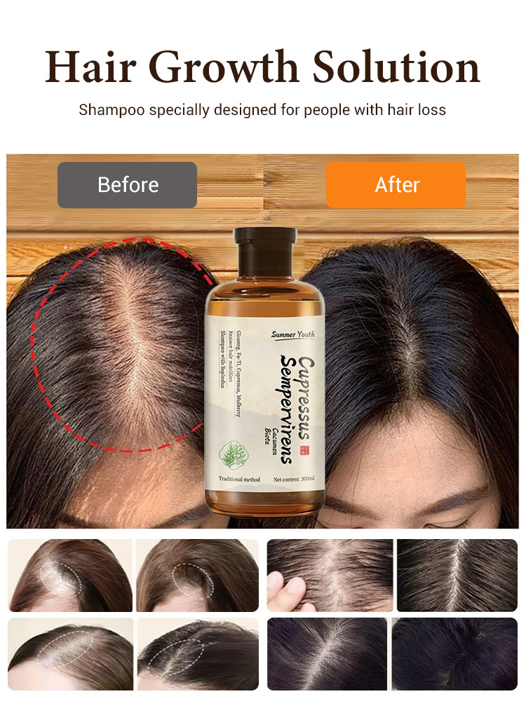 [Double Hair Volume] Anti-Hair Loss Shampoo【Personally tested and effective】