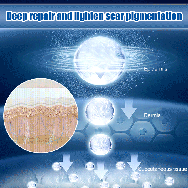 【Buy 1 free 1】Scar lightening repair cream【You can see noticeable results in just 7 days！】