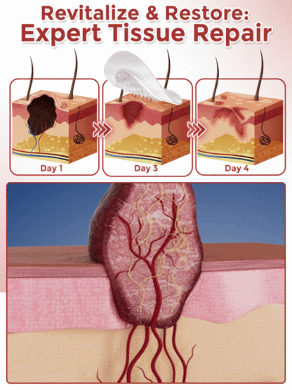 [Scar-Free] Painless Acne Patches【Buy 1 free 1】