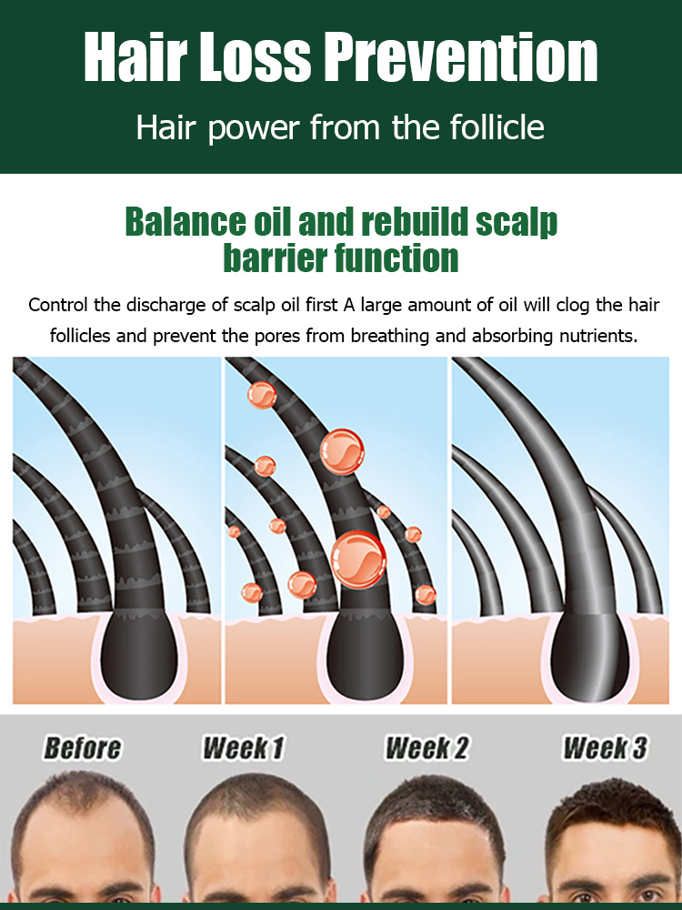 Hair Growth Essence Treatment Spray