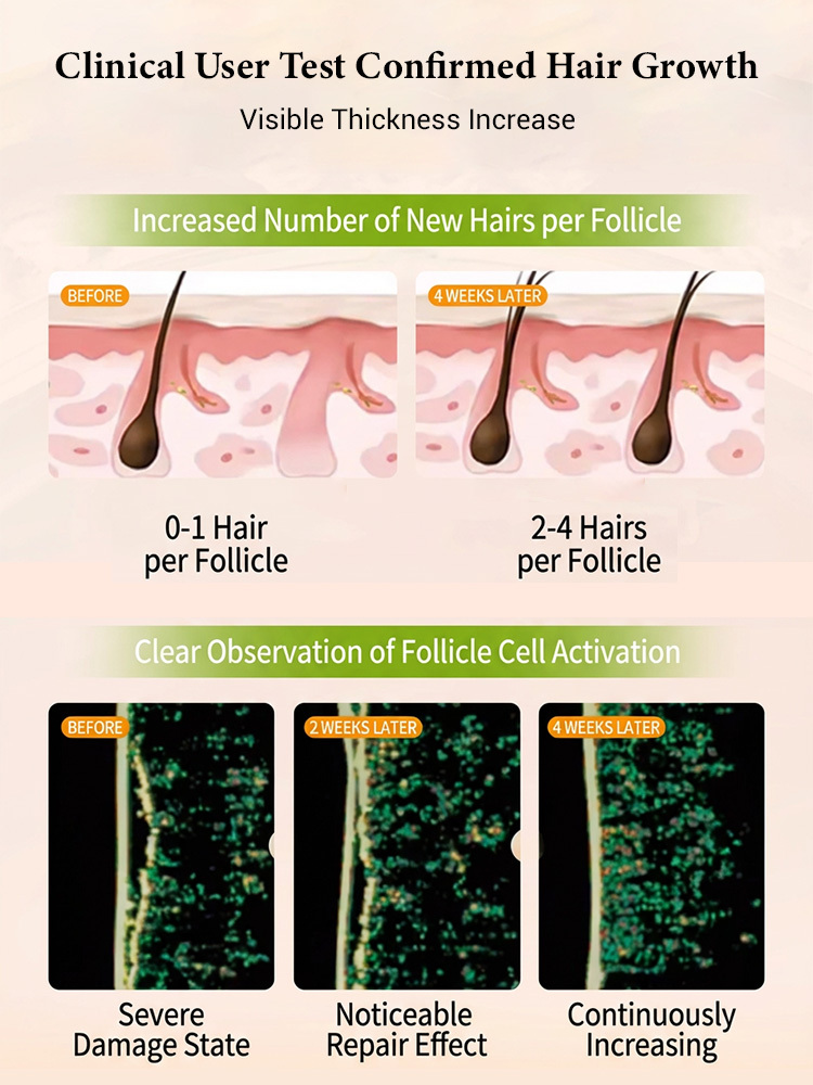 [Double Hair Volume] Anti-Hair Loss Shampoo【Personally tested and effective】