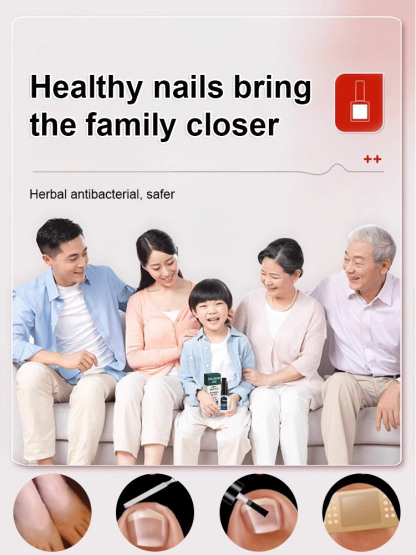 Antifungal nail repair solution