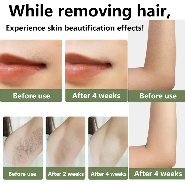 American laser hair removal instrument【Ice-point hair removal: comfortable, painless, and leaves no trace!】