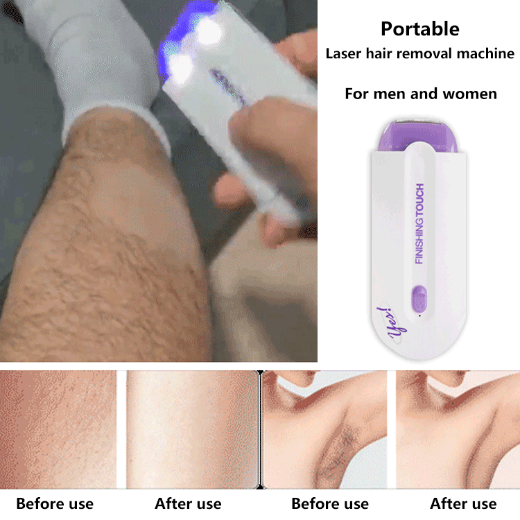 American laser hair removal instrument【Ice-point hair removal: comfortable, painless, and leaves no trace!】