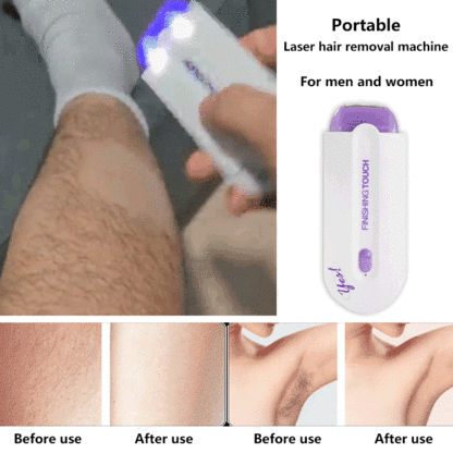 American laser hair removal instrument【Ice-point hair removal: comfortable, painless, and leaves no trace!】