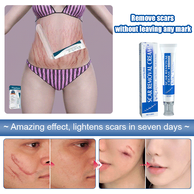 【Buy 1 free 1】Scar lightening repair cream【You can see noticeable results in just 7 days！】