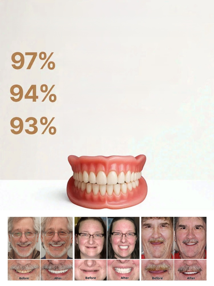 Denture Modification Kit.Naturally Invisible, Fits In One Second Without Slipping